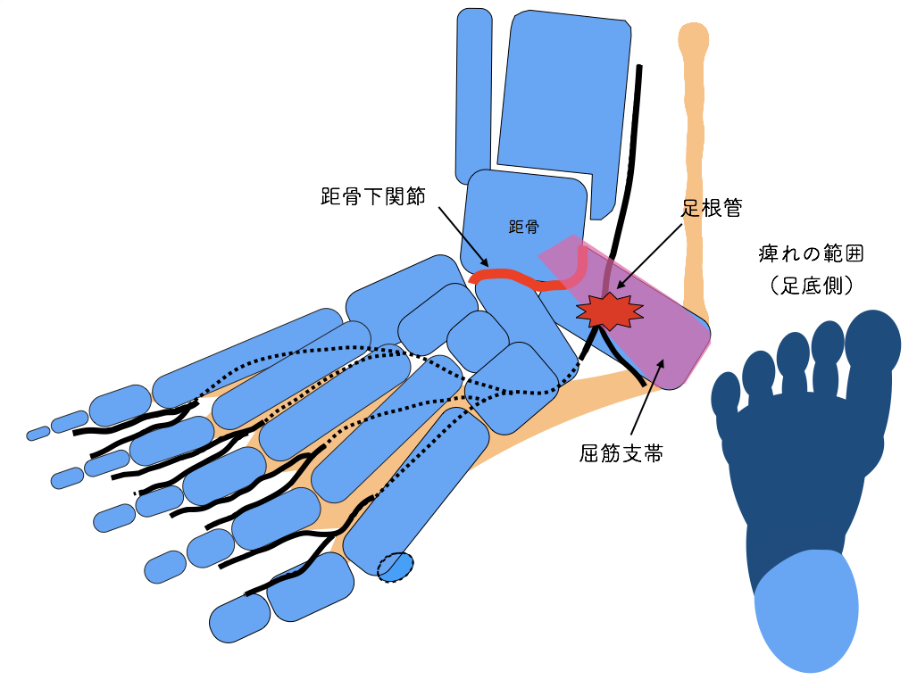 音楽耳症候群とは何ですか?